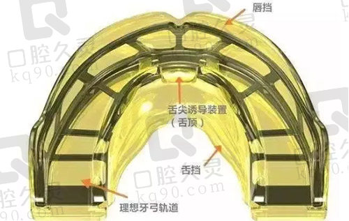 儿童MRC矫正器