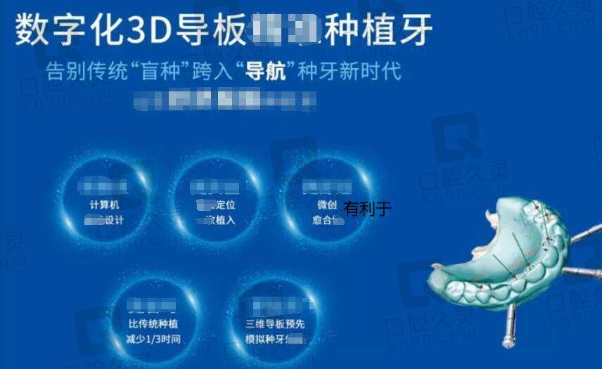 上海众齿口腔种植牙怎么样
