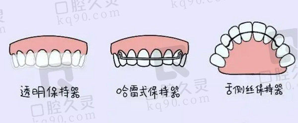 牙齿保持器种类