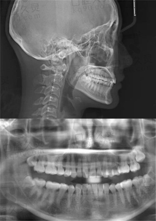 成都金牛区瑞泰口腔牙齿矫正CT照