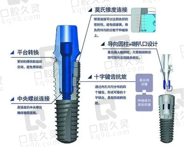 国产种植牙也是不错的