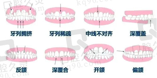 福州登特口腔齿科矫正技术优势