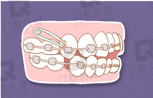 南京金伯利口腔牙齿矫正技术挺好