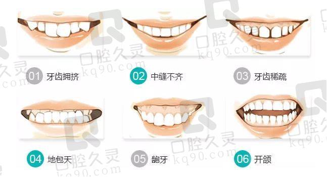 牙齿矫正