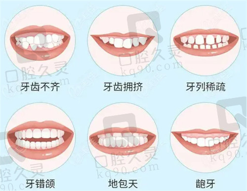 北京顺德口腔隐形矫正口碑好