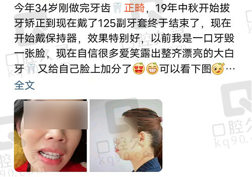 北京齐贝口腔正畸评价