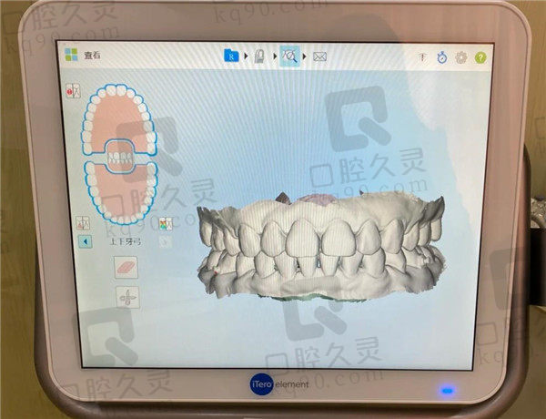 上海鹏翔口腔矫正牙口腔CT照