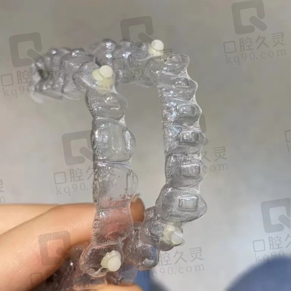 隐适美牙套