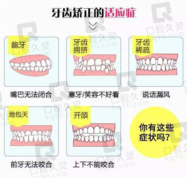 牙齿矫正