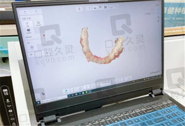 北京康贝佳口腔牙齿矫正数字模拟过程