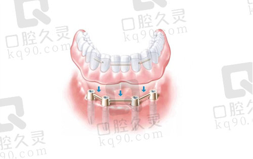 海南爱牙口腔医院看牙怎么样