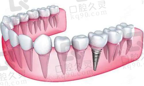 上海永华口腔医院价格表