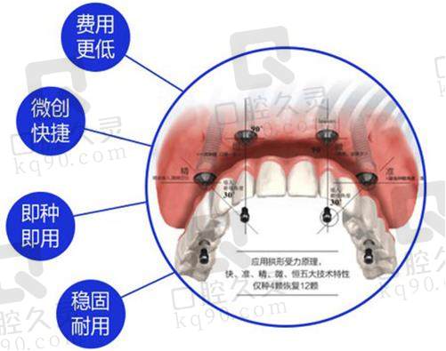 北京中诺口腔医院种植牙技术