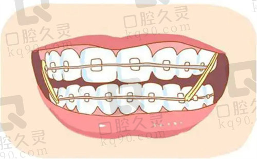 宁波牙博士牙齿矫正技术娴熟