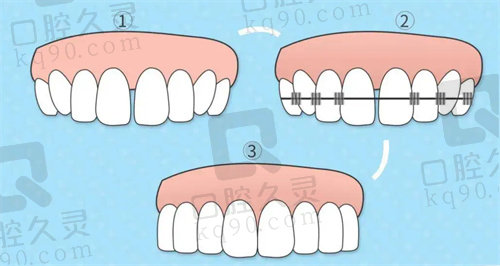 宁波牙博士牙齿矫正口碑好