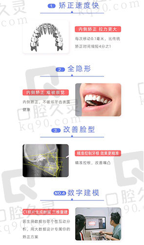 eBrace舌侧矫正优势