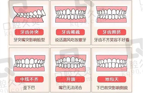 不同形态的牙齿畸形