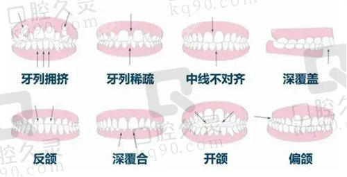 沈阳欢乐口腔牙齿矫正口碑好