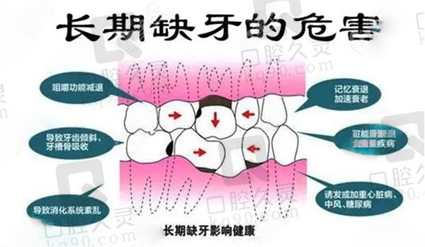 缺牙的危害