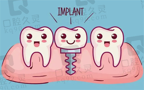 北京劲松口腔医院种植牙技术娴熟