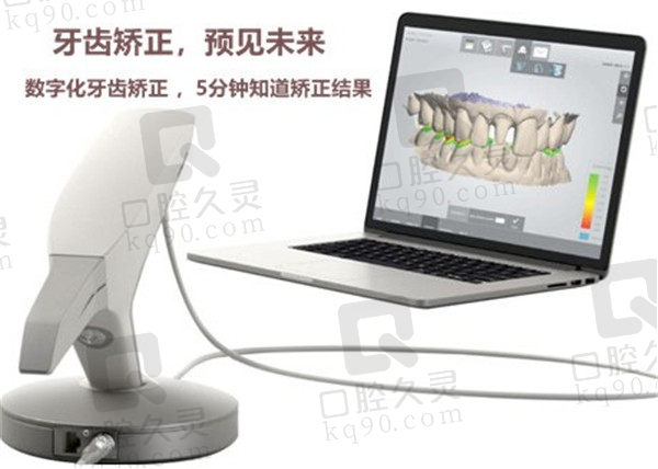 上门牙外凸面相矫正牙优势