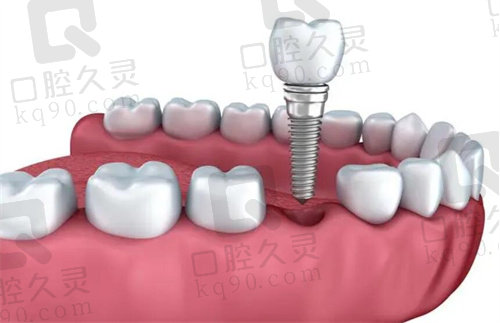 鄂尔多斯口腔医院怎么样？