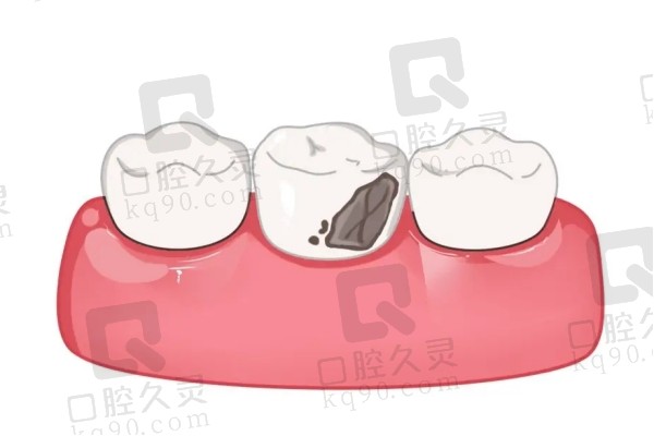 病患牙