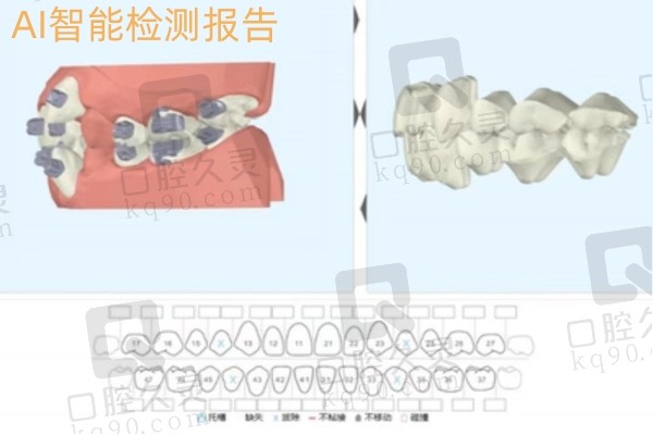 深圳麦芽口腔AI智能检测报告