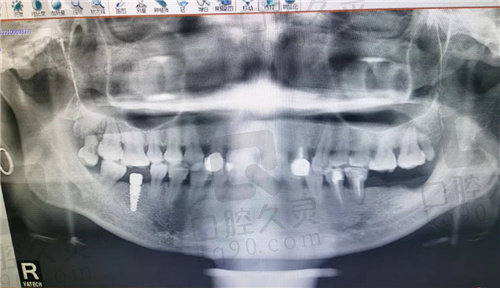 济南维乐口腔靠谱吗？