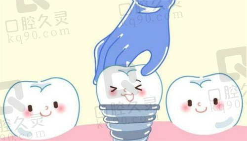 海南微笑口腔種植牙多少錢？