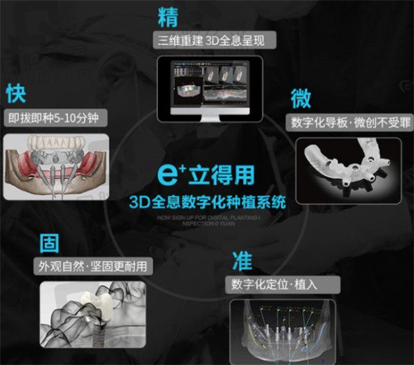 中诺口腔立得用种植牙技术优势