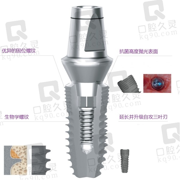 韩国登腾种植牙设计