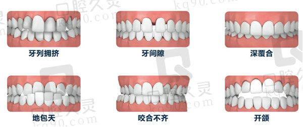 牙齿矫正