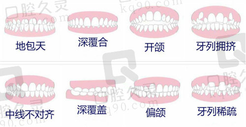 潍坊牙齿矫正比较好的医院有哪些？