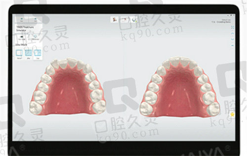 上海鼎植口腔数字化种牙