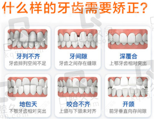 牙齿矫正