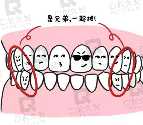 牙齿拥挤一定要拔牙矫正吗