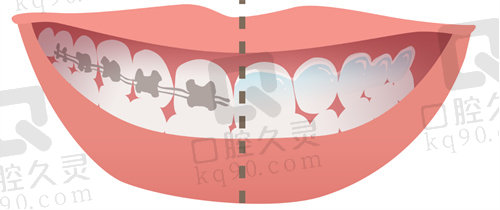 杭州美奥口腔医院牙齿矫正怎么样