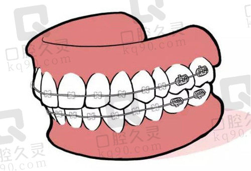 鄂尔多斯口腔医院矫正牙