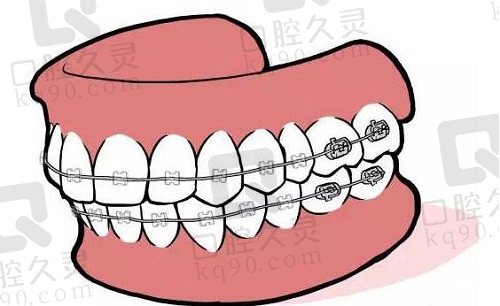 临沂铂菲克口腔医院正畸怎么样