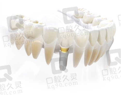 上海维乐口腔数字化种植