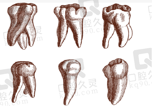  深圳慈恩齿科牙齿图