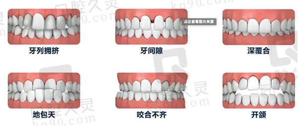 牙齿矫正