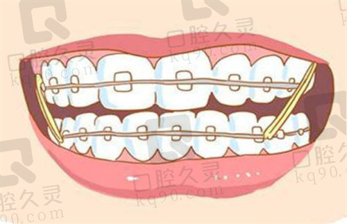 西宁非凡口腔牙齿矫正怎么样