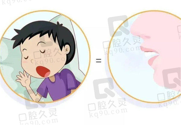 宝宝牙齿地包天是什么引起的？