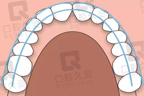 牙齒矯正 牙齒矯正
