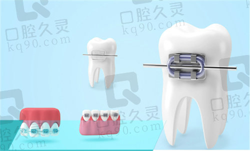 兰州皓亚口腔医院牙齿矫正多少钱