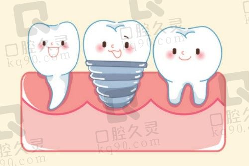北京斯迈尔口腔医院种植牙