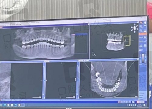 牙友对上海正睿口腔医院的口碑评价反馈