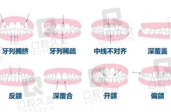 牙齿矫正